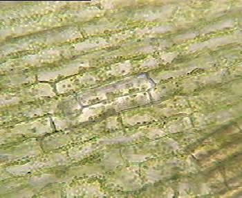 elodea cells under a microscope