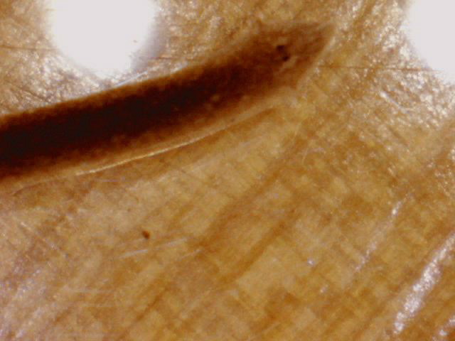 planaria